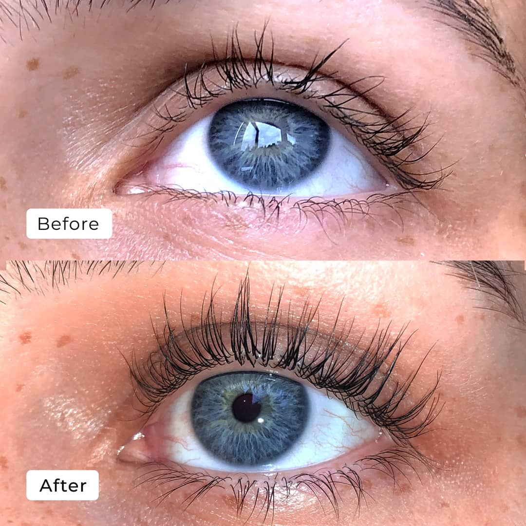 Eyelash Serum